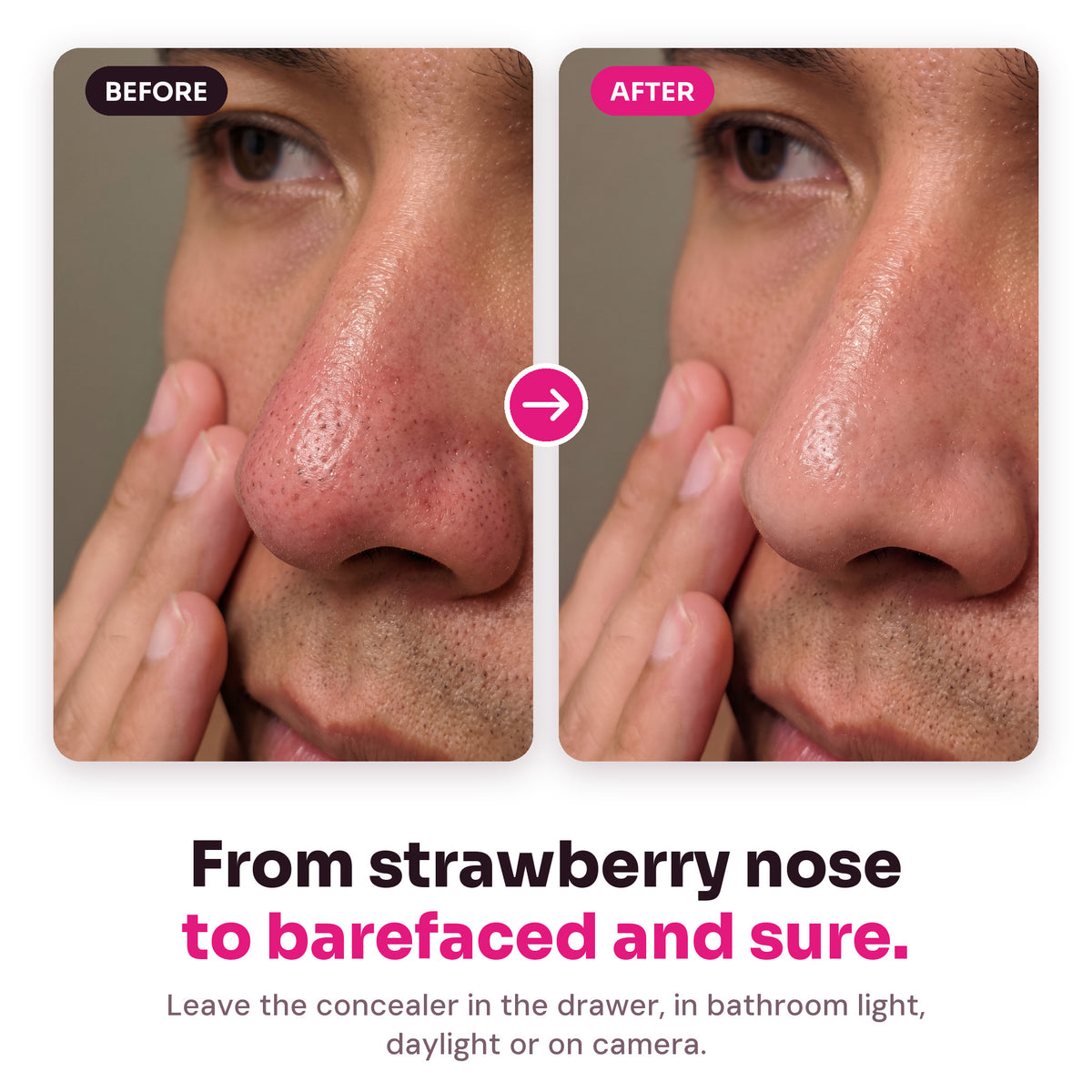 Before and after: a red nose with blackheads and the same nose looking clear
