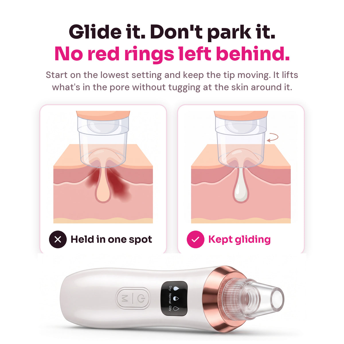 Holding a pore vacuum in one spot versus gliding it gently
