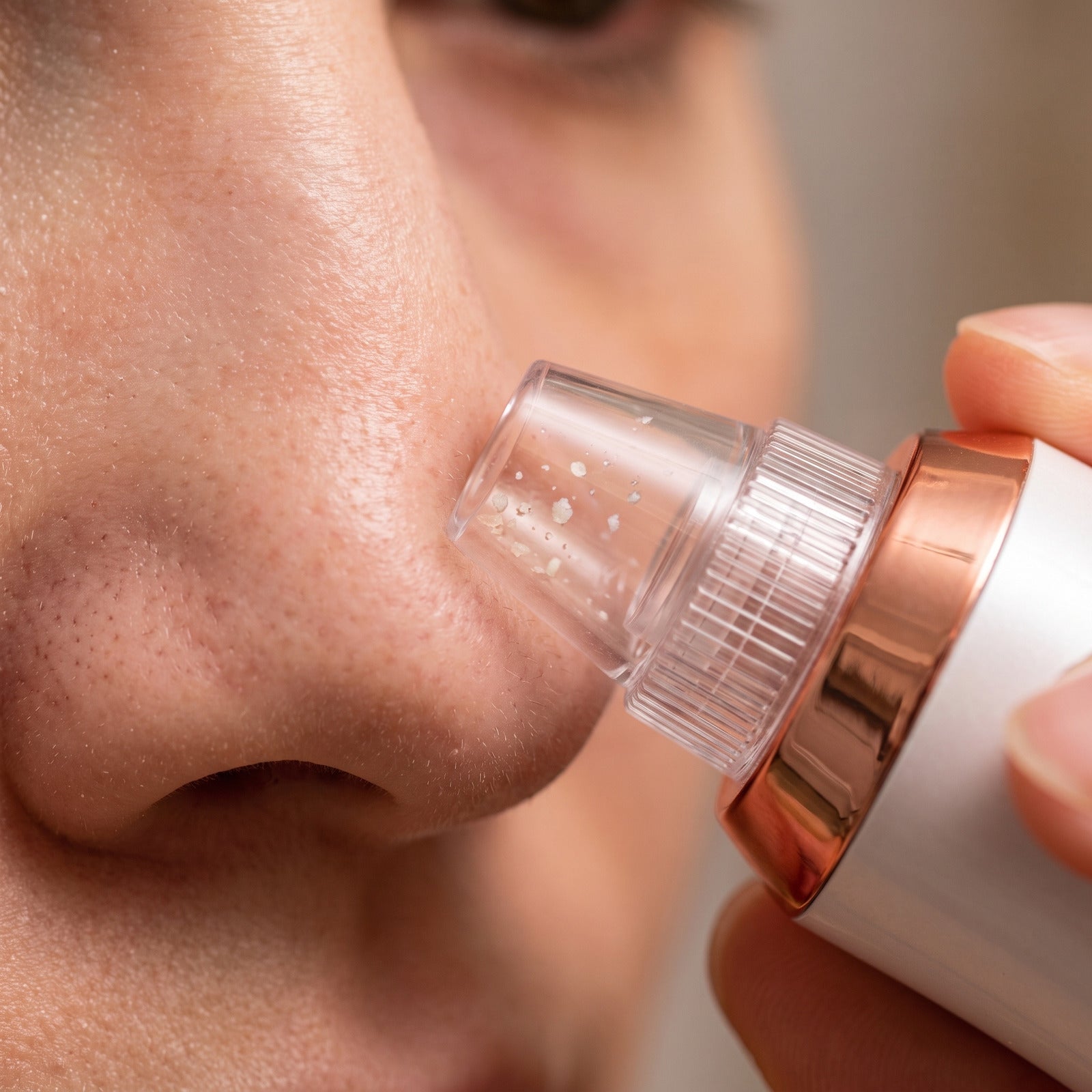 Clear RENA tip gliding over the nose with buildup visible inside
